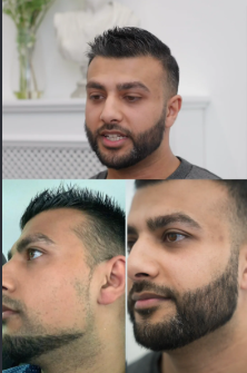 Clinical Men's Beard Styling & Trim